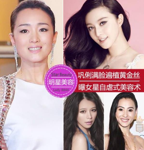 黄金丝植入术：巩俐较青睐的自虐式美容术~