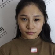 热玛吉第三代体验感受，这玩意儿不火不行啊~~ width=