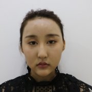 蒙古褶眼睛是什么样?果图及案例分享 width=