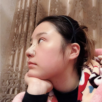 惠州鹏爱医院郭振宇教授的个性化隆鼻技术到底怎么样?