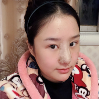 惠州鹏爱医院郭振宇教授的个性化隆鼻技术到底怎么样?