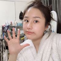 惠州鹏爱医院郭振宇教授的个性化隆鼻技术到底怎么样?