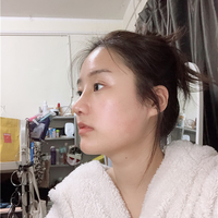 惠州鹏爱医院郭振宇教授的个性化隆鼻技术到底怎么样?