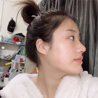惠州鹏爱医院郭振宇教授的个性化隆鼻技术到底怎么样?