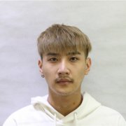常熟瑞丽医院鼻头缩小技术如何?小哥哥案例分享 width=