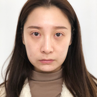 卓彦诊所价目表曝光，附面部************案例及其果图