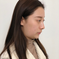 卓彦诊所价目表曝光，附面部************案例及其果图