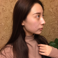 卓彦诊所价目表曝光，附面部************案例及其果图