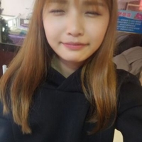 袁志杰牙齿矫正技术如何?恢复期需要多久?