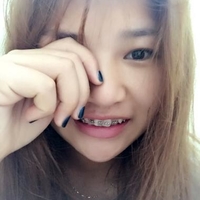 袁志杰牙齿矫正技术如何?恢复期需要多久?