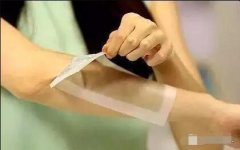 复合彩光脱毛案例分享：三个月彻底解决毛毛手 width=