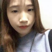 上海伊美尔港华怎样?【割双眼皮25天恢复对比图】 width=