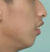 龅牙哥茫然弟看过来，你们的救星在这里！ width=