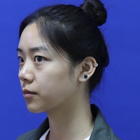 郭栋梁为何做双眼皮这么牛逼?小档案曝光