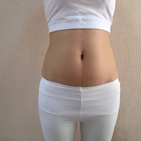 济南芭莎美恩吸脂技术怎么样?正规吗?