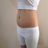 济南芭莎美恩吸脂技术怎么样?正规吗?