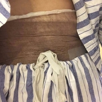 济南芭莎美恩吸脂技术怎么样?正规吗?