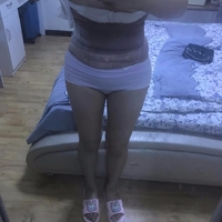 济南芭莎美恩吸脂技术怎么样?正规吗?