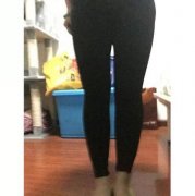伊美尔幸福医院光纤微创溶脂案例：管住嘴迈开腿是做不到的~ width=