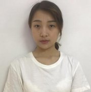胡琼华切开双眼皮案例对比恢复情况：全家人都支持我做双眼皮~ width=