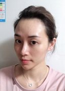 埋眼线前后对比图曝光分享：你和美丽就差两根线 width=