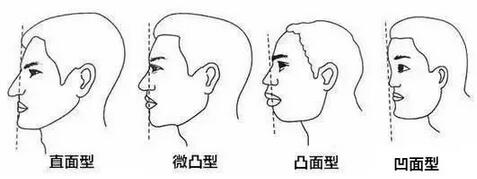 韩国双鄂手术真实经历全纪录，珍贵的资料~