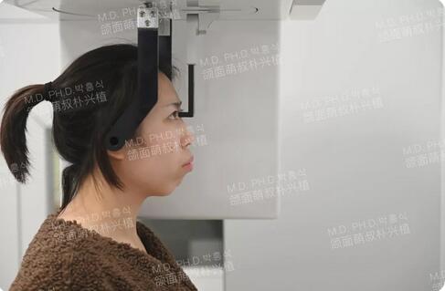 韩国双鄂手术真实经历全纪录，珍贵的资料~