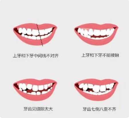 韩国双鄂手术真实经历全纪录，珍贵的资料~