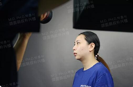 韩国双鄂手术真实经历全纪录，珍贵的资料~