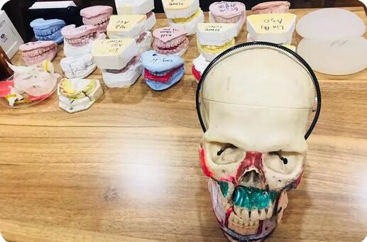 韩国双鄂手术真实经历全纪录，珍贵的资料~