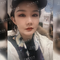 磨颧骨前后对比图，变化是不是很惊人
