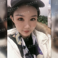 磨颧骨前后对比图，变化是不是很惊人