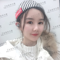 磨颧骨前后对比图，变化是不是很惊人