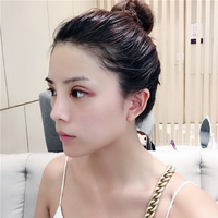昆山百达丽整形医院沈国雄院长做双眼皮果好吗?在线求解~~~
