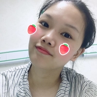 倪彬院长软骨隆鼻案例流出，并附上前后对比图展示