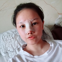 倪彬院长软骨隆鼻案例流出，并附上前后对比图展示