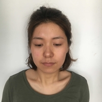 唐振利做鼻子怎么样?唐振利案例分享