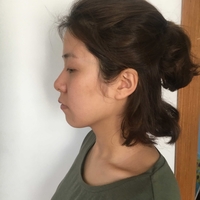 唐振利做鼻子怎么样?唐振利案例分享