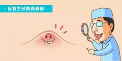 红蓝光调节仪去痤疮果好吗？一起来看看！ width=