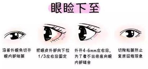 上海九院眼部手术做得好不好?