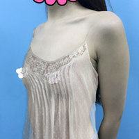 沈阳奉天整形医院隆胸技术如何?胸小很烦恼~