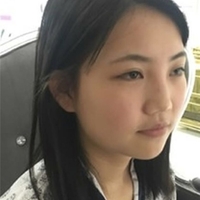 武汉伽美医疗美容医院技术如何?这鼻子已随我征战二十余载