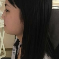武汉伽美医疗美容医院技术如何?这鼻子已随我征战二十余载