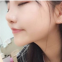 武汉伽美医疗美容医院技术如何?这鼻子已随我征战二十余载
