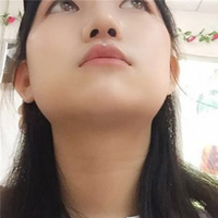武汉伽美医疗美容医院技术如何?这鼻子已随我征战二十余载