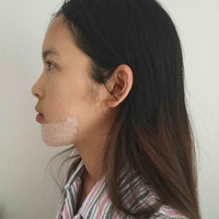 名人医美连锁实力如何?能否让我人见人爱