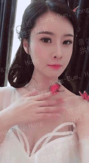 首尔丽格洪性范长曲线下颌角整形案例，有对比果图片哟~