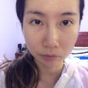 激光美容澳玛星光医院如何?听说技术源于以色列? width=