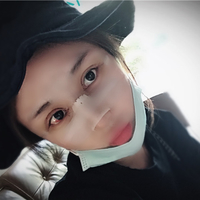 杜太超隆鼻失败修复技术真的好吗?我仿佛看见了希望