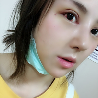 杜太超隆鼻失败修复技术真的好吗?我仿佛看见了希望